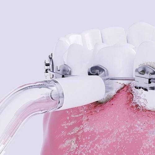 歯科矯正用ノズル ジェットフロス用 クリア ヤーマン YOI-OD2