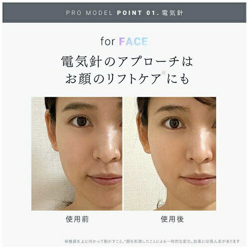 電気針ヘッドスパ EMS HEAD SPA PRO MYTREX MT-EHP22B